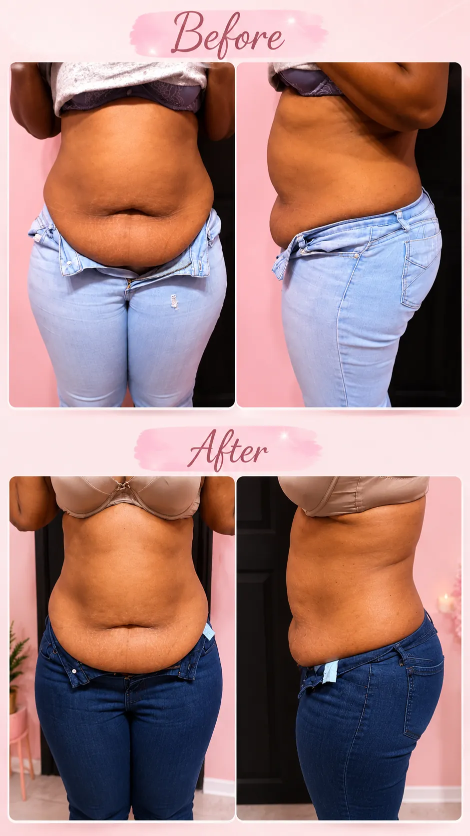 Fat Melting Results before and after
