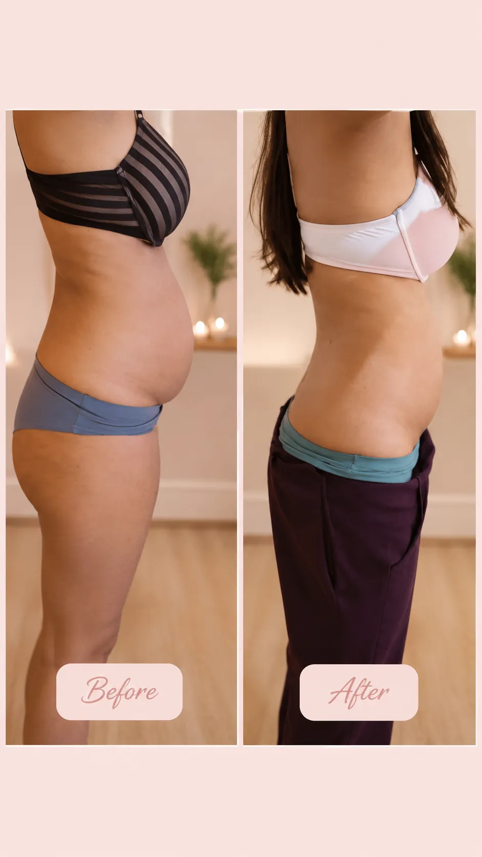Skin Tightening Results before and after