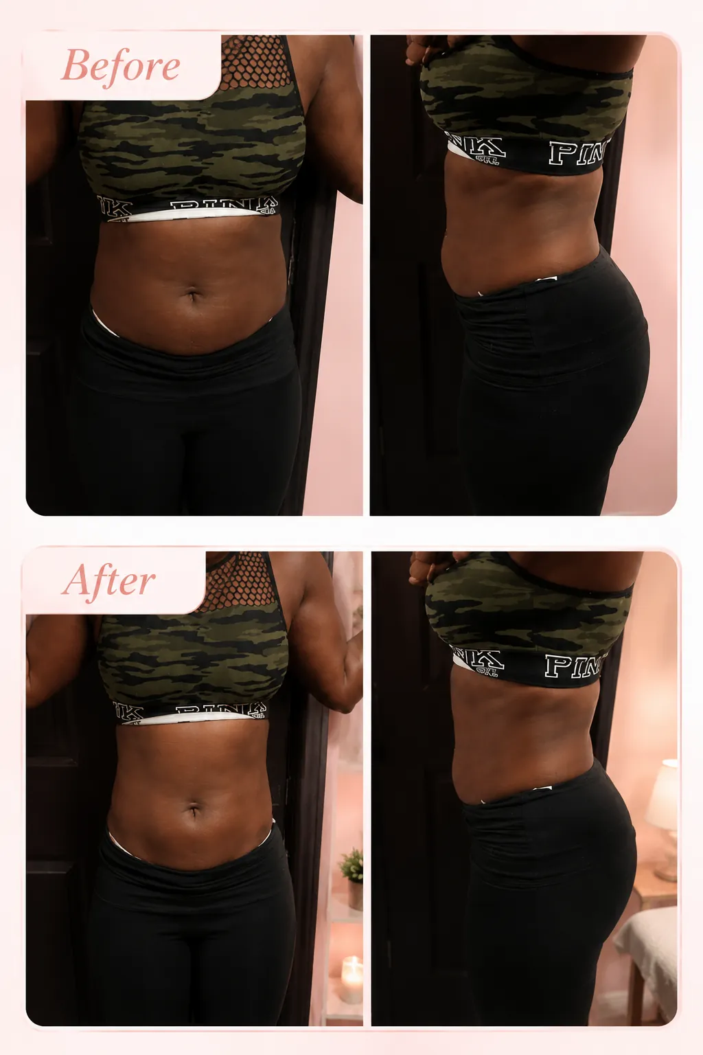 Body Contouring Results before and after
