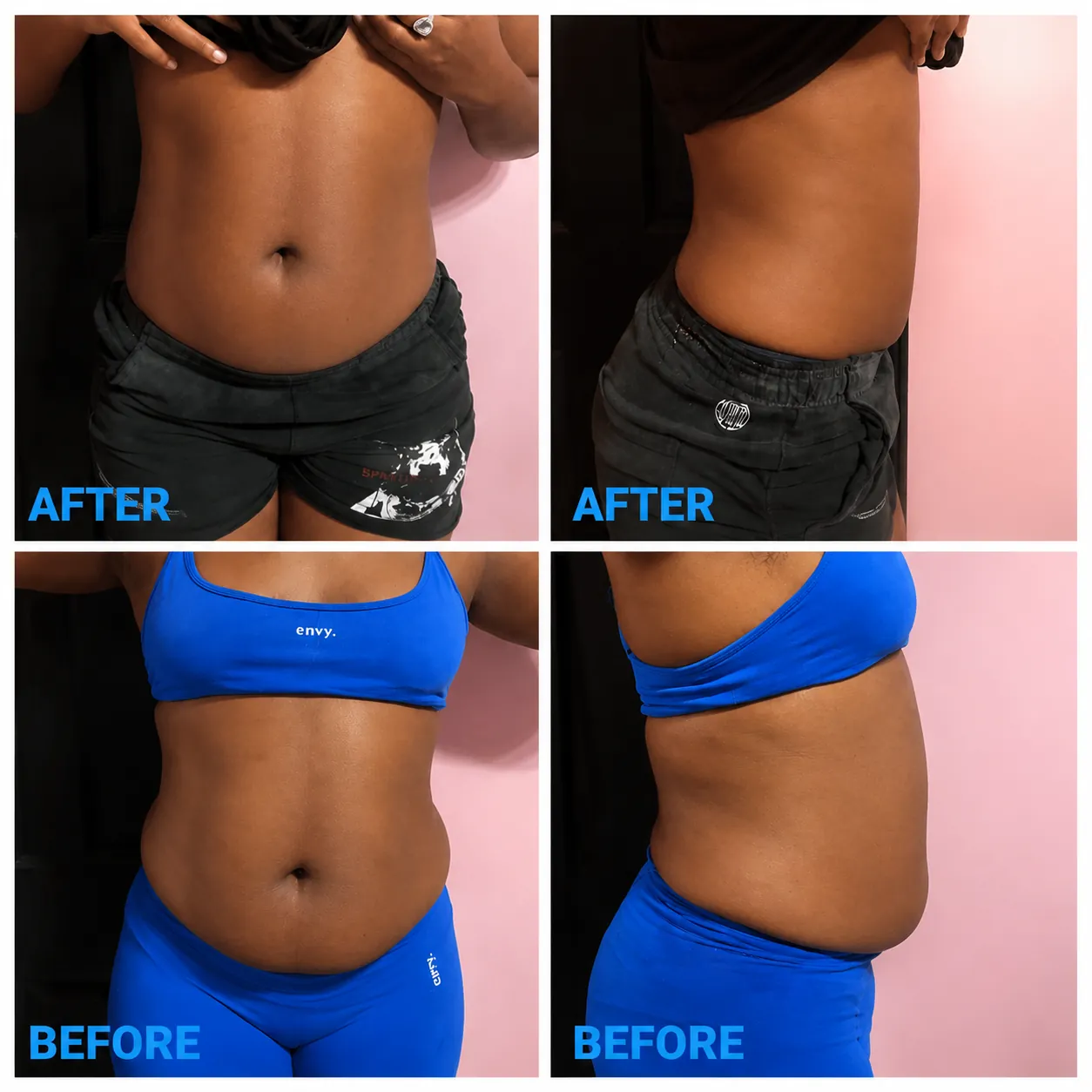 Facial Results before and after